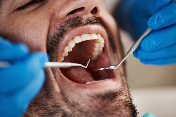 Best Oral Cancer Screening  in Willamina, OR
