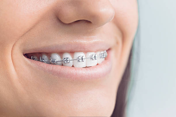 Best Dental Fillings (Composite and Amalgam)  in Willamina, OR